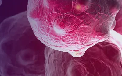 Vad innebär individanpassad vård ur ett cancerperspektiv?